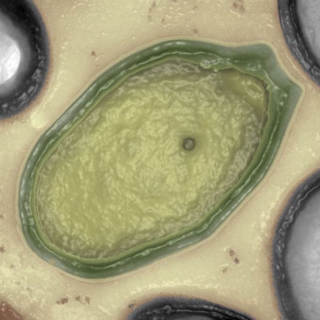 Pandoravirus