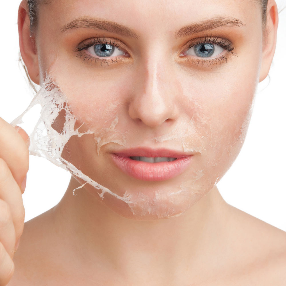 peeling
